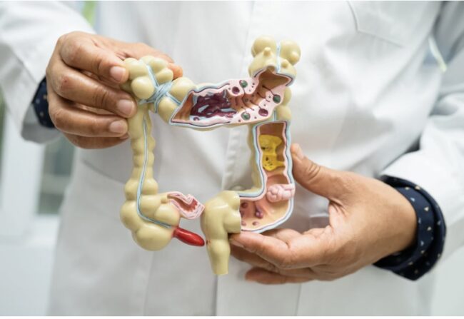 How does the gut microbiome affect your health